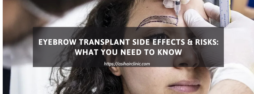 Eyebrow Transplant Side Effects & Risks: What You Need to Know