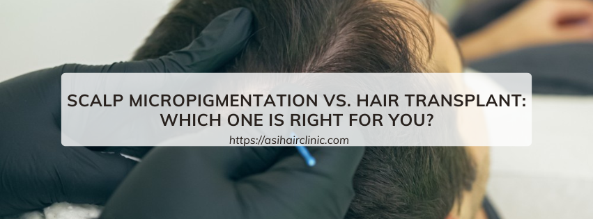 Scalp Micropigmentation vs. Hair Transplant: Which One Is Right for You?