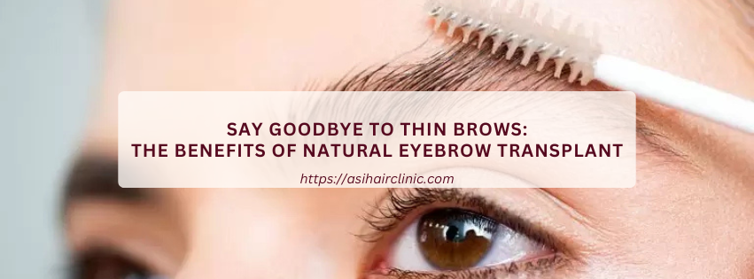 Say Goodbye to Thin Brows: The Benefits of Natural Eyebrow Transplant