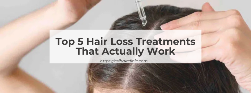 Top 5 Hair Loss Treatments That Actually Work